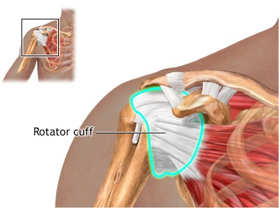 Rotator Cuff Pain