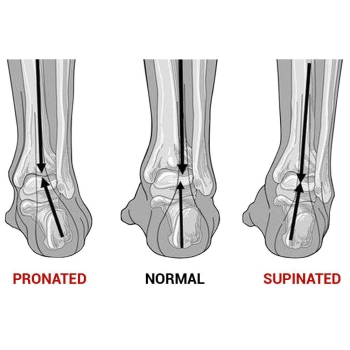 does biofreeze work for shin splints