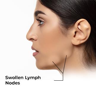 Swollen Lymph Nodes: Causes and Treatment Options