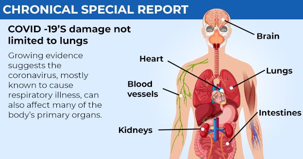 Covide-19 Damage Covide-19 Damage not limited to lungs