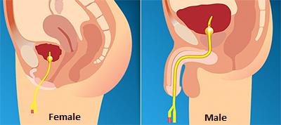 Foley Catheters