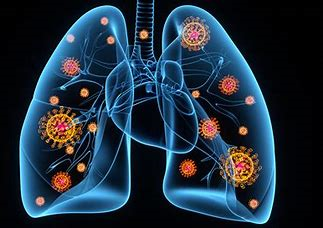 Covid-19 Recovery Covid-19 Recovery