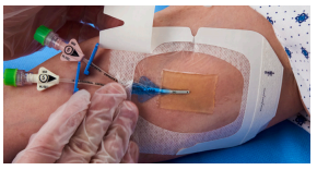 Buy 3M Tegaderm CHG IV Securement Dressings [FSA Approved]