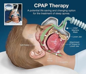 All About CPAP All About CPAP