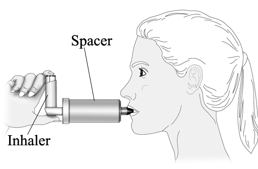 Asthma Spacers - For Effective Medication Delivery