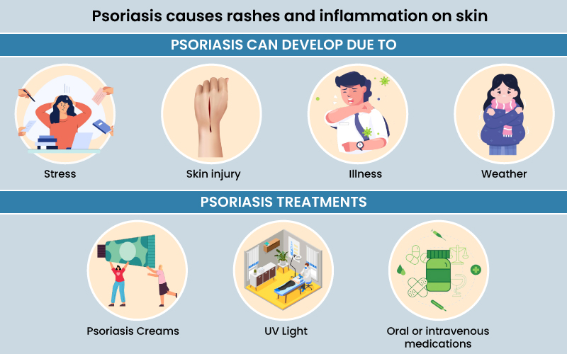 cause of psoriasis