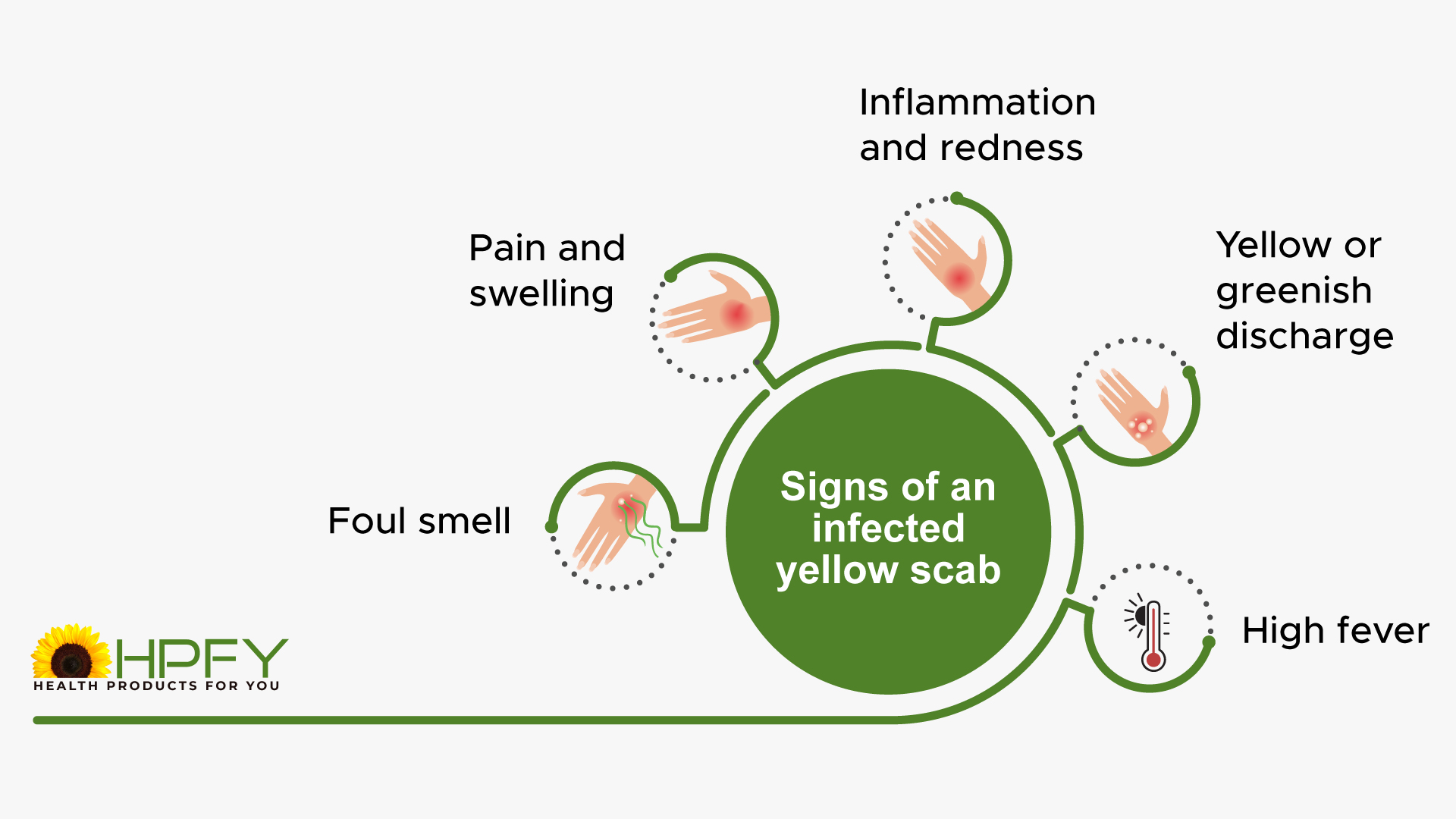 Signs of an infected scab