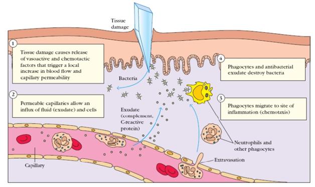 wound infection diagram