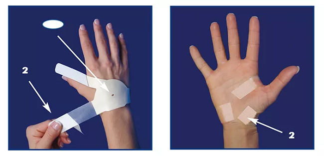 The Carpal Solution Carpal Tunnel Brace: Step-by-Step Instructions